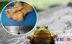 聽信偏方吞青蛙進補 杭州漢染寄生蟲反惹大病