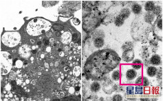 Omicron疫情｜港大醫學院發布電子顯微鏡下Omicron變異株圖片