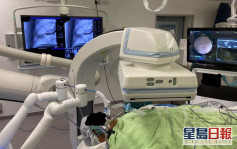 中大以混合手術室機械人輔助支氣管鏡檢查手術 美國以外首例