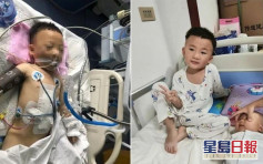 4歲奇跡男孩 28樓墮下重傷1個月後已能站立