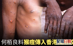 猴痘传染性不高 何栢良料传入香港风险较低