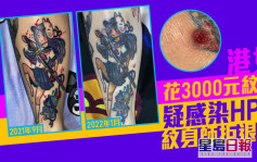 Juicy叮｜港女花3000元紋身疑感染HPV 紋身師拒退款：於事無補