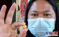 食海螺发现约值39万「珍珠王」 泰贫穷女放售筹钱医癌病母