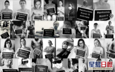 法国医护拍裸照抗议医疗设备短缺