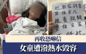 廣東6歲女童被潑熱水毀容  復學首天再收恐嚇信