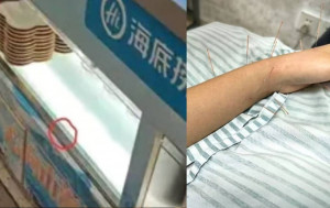 江苏海底捞︱女客触电神经受损 分店拒赔偿因……