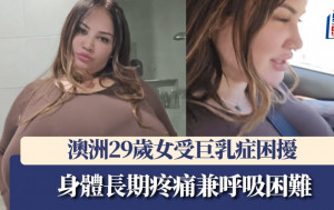 胸部比頭還要大 澳洲29歲女受巨乳症困擾 身體長期疼痛兼呼吸困難