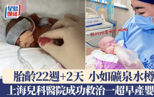 胎齡僅22周比礦泉水瓶還小　上海的醫院成功救治一名超早產兒嬰兒