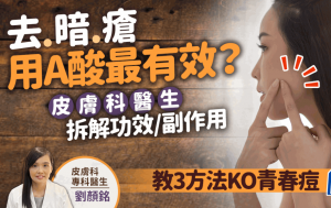 去暗疮用A酸最有效？皮肤科医生拆解功效副作用 教3方法解决青春痘