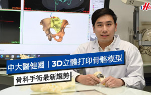 中大医健园｜3D立体打印骨骼模型 骨科手术最新趋势