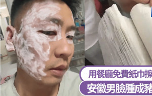 毒紙巾？用餐廳紙巾擦汗後險毀容 安徽男臉腫成豬頭