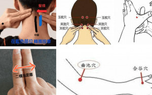 專欄 運動醫道│多方面入手預防頸椎病