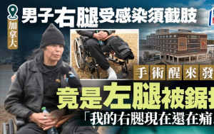 截肢「切錯腳」｜男子右腿感染做手術　麻醉醒來驚見左腿沒了