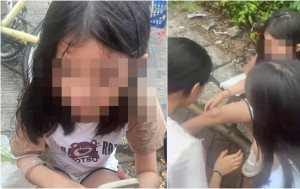 上水9岁女童疑遭的士撞伤 头破血流牙崩 司机逃逸网民求片缉凶