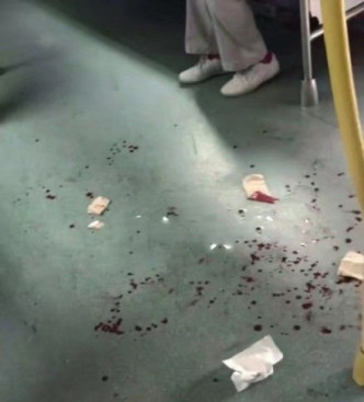 地铁车厢溅满男子的鲜血。（网图）
