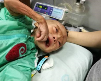 重慶巫溪1歲男嬰黃潔宇患上怪病，1年中每日腹瀉10-30多次。網圖
