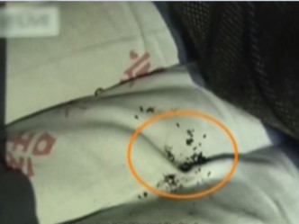 醫護人員發現陳伯的床上有煙蒂和火機。 網上圖片
