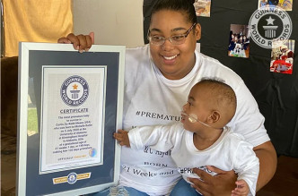 Curtis获「存活下来最早产婴儿」的健力士世界纪录。