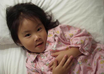 李嫣先天性唇腭裂（兔唇），3個月大時已接受了第一次矯正手術，天生缺陷冇影響到童年成長。