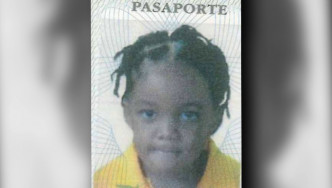 牙買加5歲男童艾倫遭野狗襲擊致血肉模糊。網上圖片