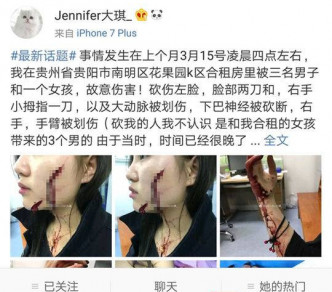 受害女子劉雪琪，在微博留言講述了自己可怕的遭遇。（網圖）