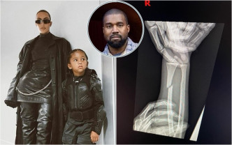 Kanye与Kim的5岁囝囝手臂受伤。