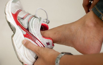 脚臭可能是患上香港脚。资料图片