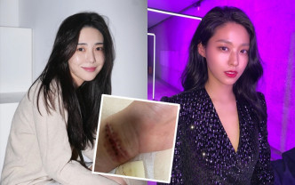 珉娥再貼手腕傷疤照觸目驚心；她直指雪炫與其他成員，在她被欺凌時都是旁觀者。