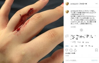 坂口杏里在社交网上载一张手指受伤的照片。网图