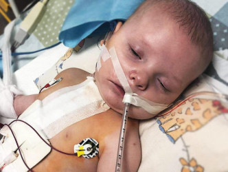 8個月大的Milos患有多重心臟及靜脈問題。網上圖片