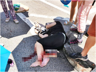 一名女途人腳部嚴重受傷。網圖