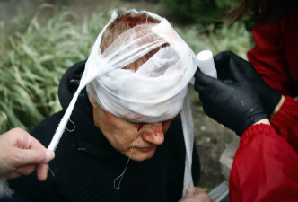 有示威者当场受伤溅血，由医护人员包扎。AP图片