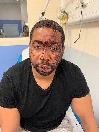 黑人泽莱被数名警员殴打。AP