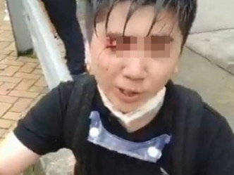 右眼受伤的男教师杨子俊。网图