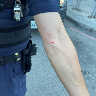 警员手臂受伤。