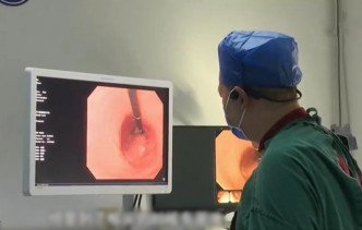 医生用胃镜为事主检查。互联网图片