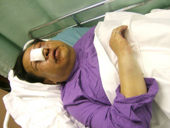 何俊仁在06年曾遇袭入院。资料图片
