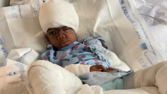牙買加5歲男童在紐約進行手術後保住性命。網上圖片