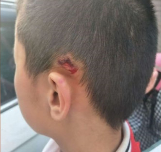 男童头部受伤。网图