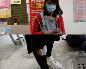 其中一名女伤者（马小姐）送往联合医院，经治疗后出院。 梁国峰摄