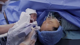 张丽君在15年12月、怀孕个月时剖腹，顺利诞下孩子「小笼包」。