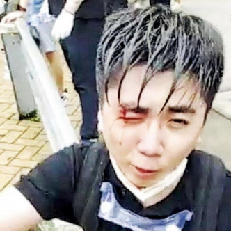 楊子俊在612事件中右眼受傷。網圖