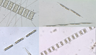 顯微鏡下的矽藻。科大提供