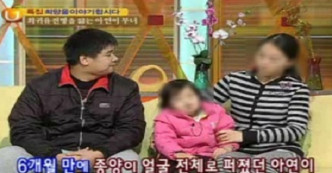 李永学和妻子曾上电视节日为女儿医药费筹款。 网上图片