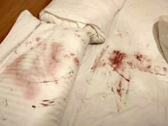 曾有客人将屋内的白色浴巾、毛巾及床单都弄到鲜血。影片截图