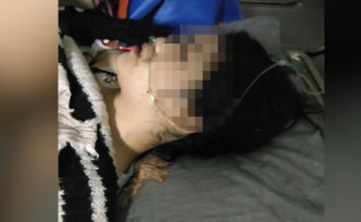 雲南少女被迫賣淫，情急之下跳樓逃生命危。網圖