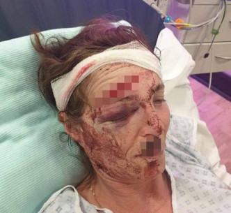 英国一对夫妻被袭击重伤。网上图片