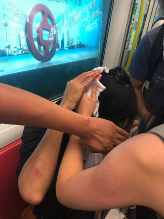 有乘客頭部受傷。網民Elmo Lau