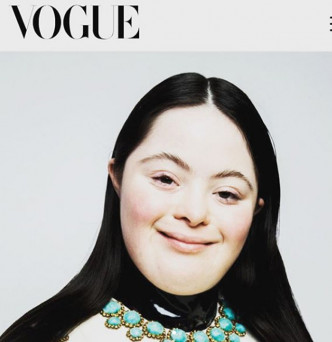 艾丽成《Vogue》首位唐氏综合症模特儿。  Ellie Goldstein IG图