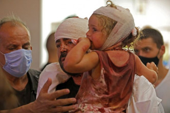 大爆炸的傷者包括兒童，獲送院治理。（©UNICEF/UNI356311/Amro/AFP）